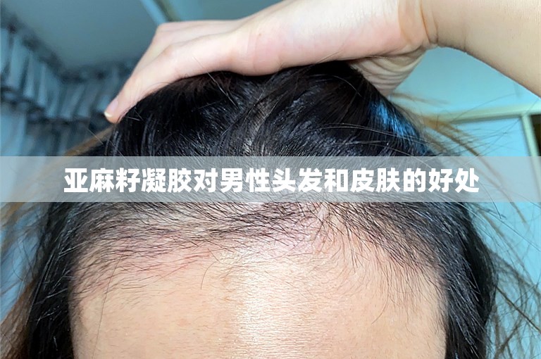 亚麻籽凝胶对男性头发和皮肤的好处