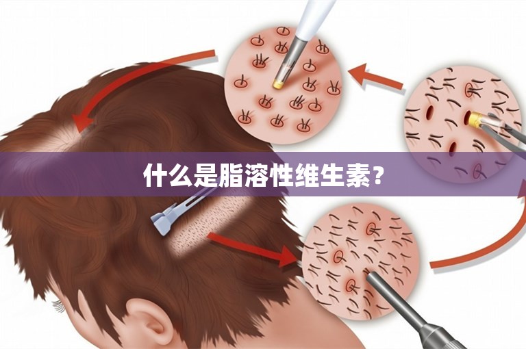 什么是脂溶性维生素？