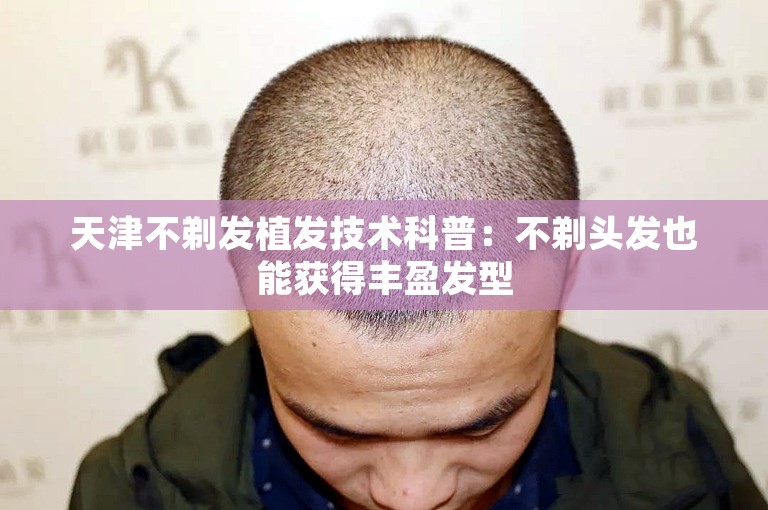 天津不剃发植发技术科普：不剃头发也能获得丰盈发型