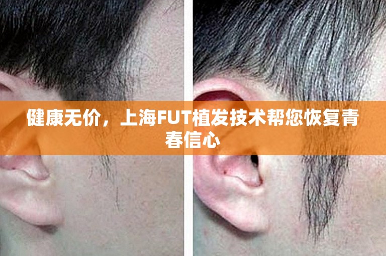 健康无价，上海FUT植发技术帮您恢复青春信心