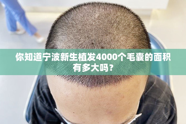 你知道宁波新生植发4000个毛囊的面积有多大吗？