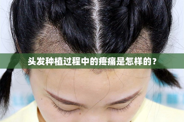 头发种植过程中的疼痛是怎样的？