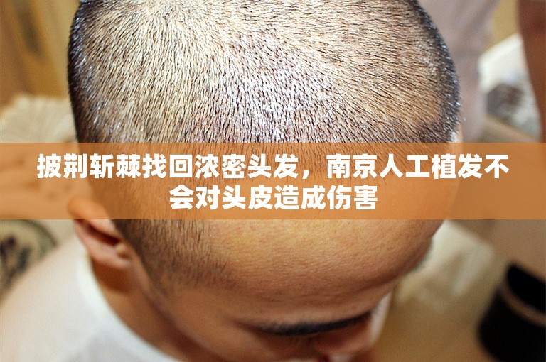 披荆斩棘找回浓密头发，南京人工植发不会对头皮造成伤害