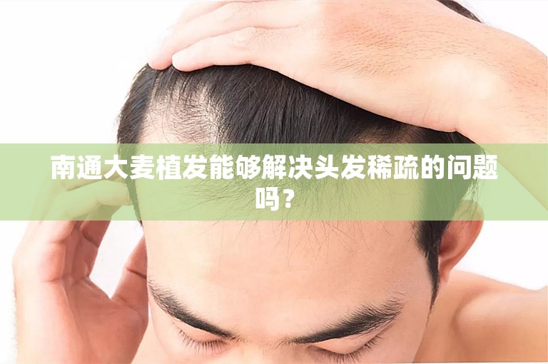 南通大麦植发能够解决头发稀疏的问题吗？