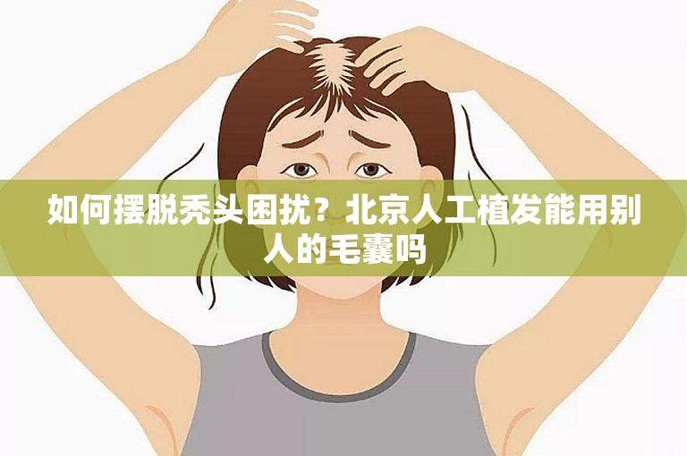 如何摆脱秃头困扰？北京人工植发能用别人的毛囊吗