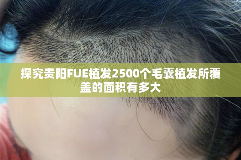 探究贵阳FUE植发2500个毛囊植发所覆盖的面积有多大