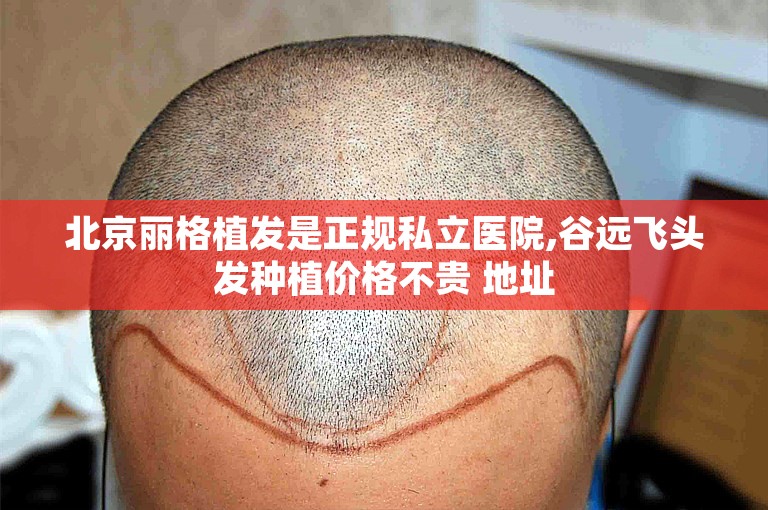 北京丽格植发是正规私立医院,谷远飞头发种植价格不贵 地址