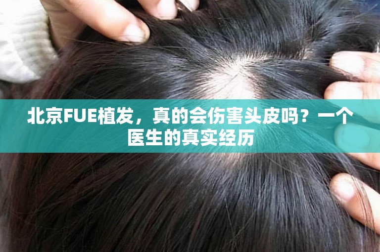 北京FUE植发，真的会伤害头皮吗？一个医生的真实经历