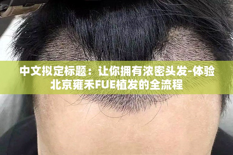 中文拟定标题：让你拥有浓密头发-体验北京雍禾FUE植发的全流程