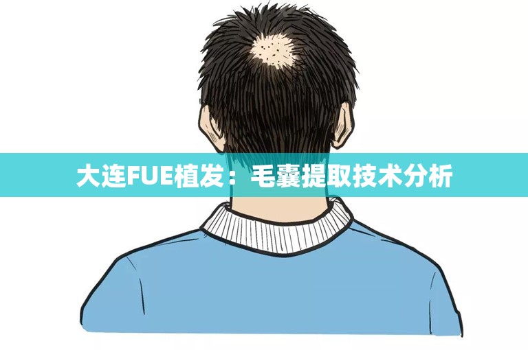大连FUE植发：毛囊提取技术分析