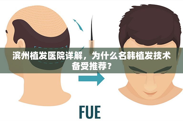 滨州植发医院详解，为什么名韩植发技术备受推荐？