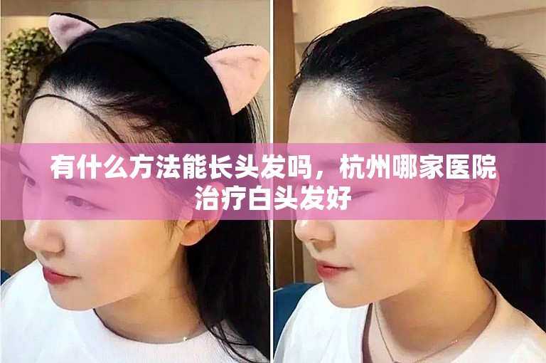 有什么方法能长头发吗，杭州哪家医院治疗白头发好