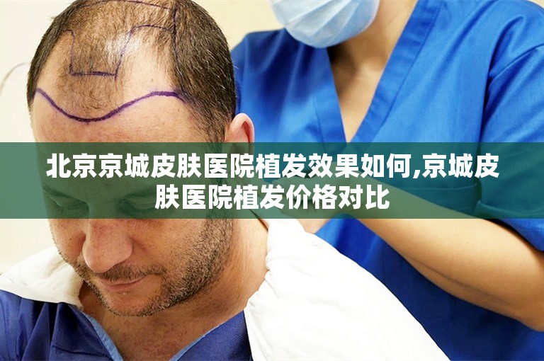 北京京城皮肤医院植发效果如何,京城皮肤医院植发价格对比