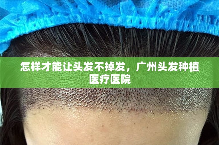怎样才能让头发不掉发，广州头发种植医疗医院