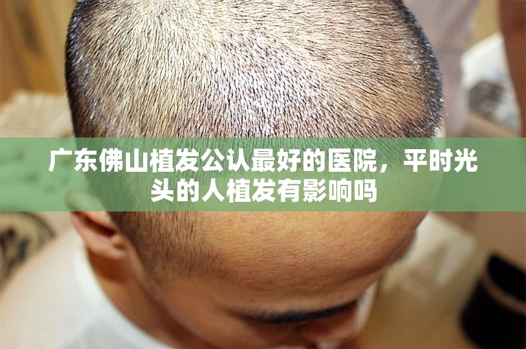 广东佛山植发公认最好的医院，平时光头的人植发有影响吗