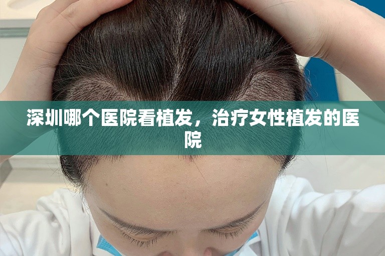 深圳哪个医院看植发，治疗女性植发的医院