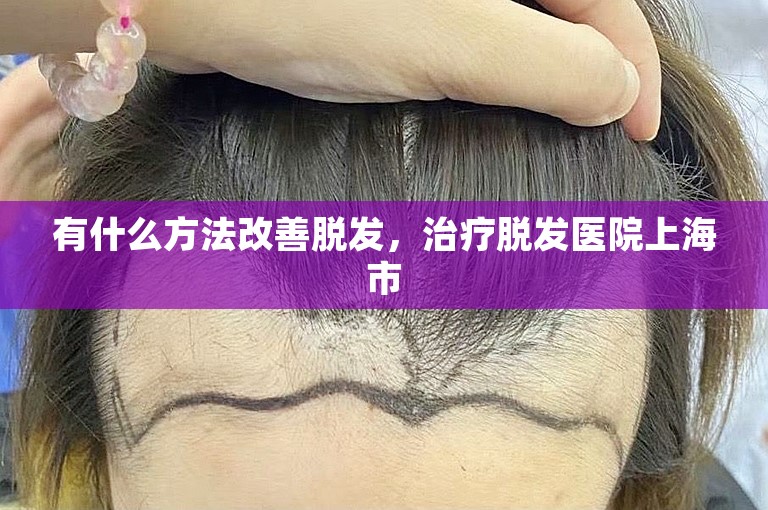 有什么方法改善脱发，治疗脱发医院上海市