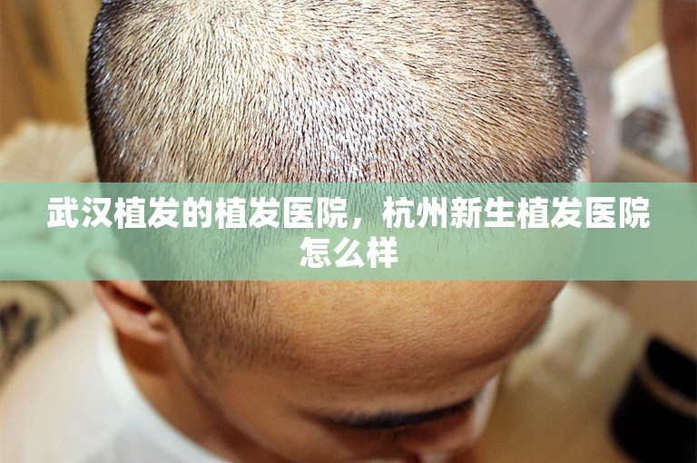 武汉植发的植发医院，杭州新生植发医院怎么样
