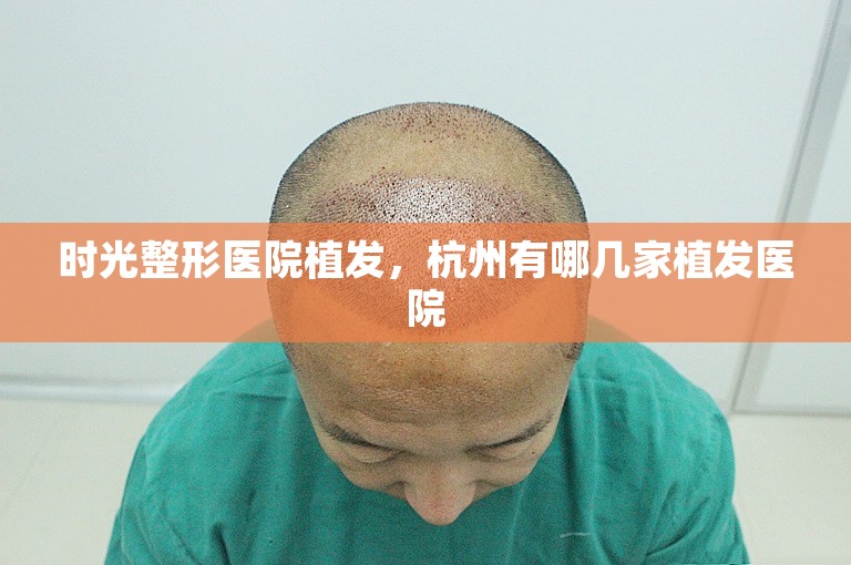 时光整形医院植发，杭州有哪几家植发医院