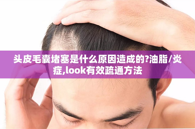 头皮毛囊堵塞是什么原因造成的?油脂/炎症,look有效疏通方法