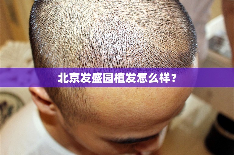 北京发盛园植发怎么样？