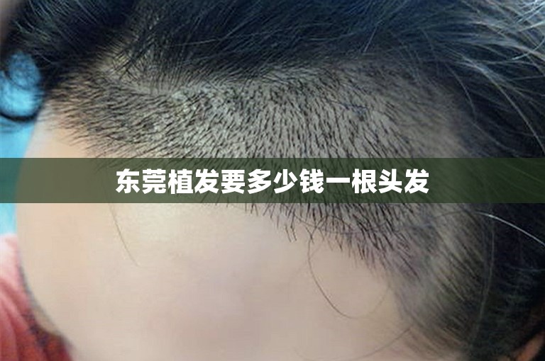 东莞植发要多少钱一根头发
