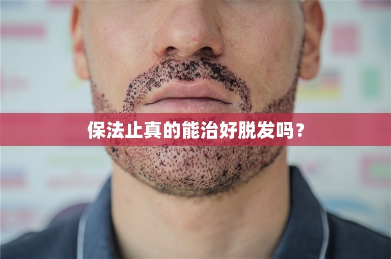 一颗头发的重量：中国脱发人士的“南昌大麦植发医院”经历