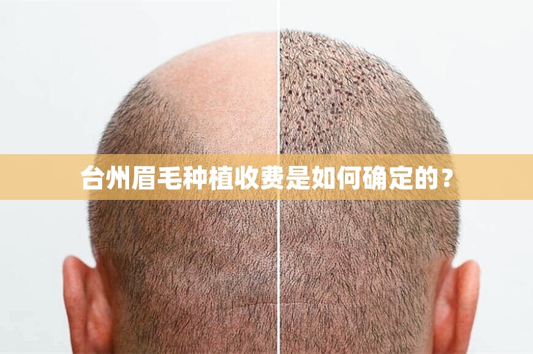 台州眉毛种植收费是如何确定的？