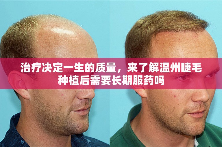 治疗决定一生的质量，来了解温州睫毛种植后需要长期服药吗