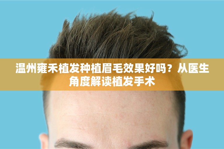温州雍禾植发种植眉毛效果好吗？从医生角度解读植发手术