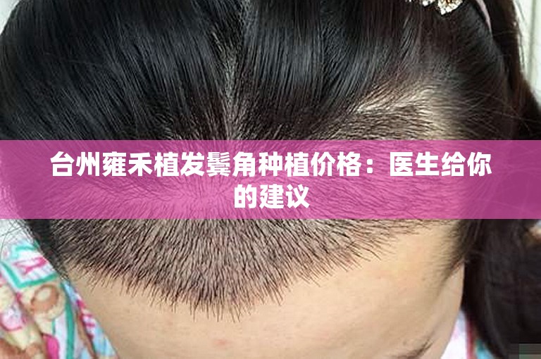 台州雍禾植发鬓角种植价格：医生给你的建议