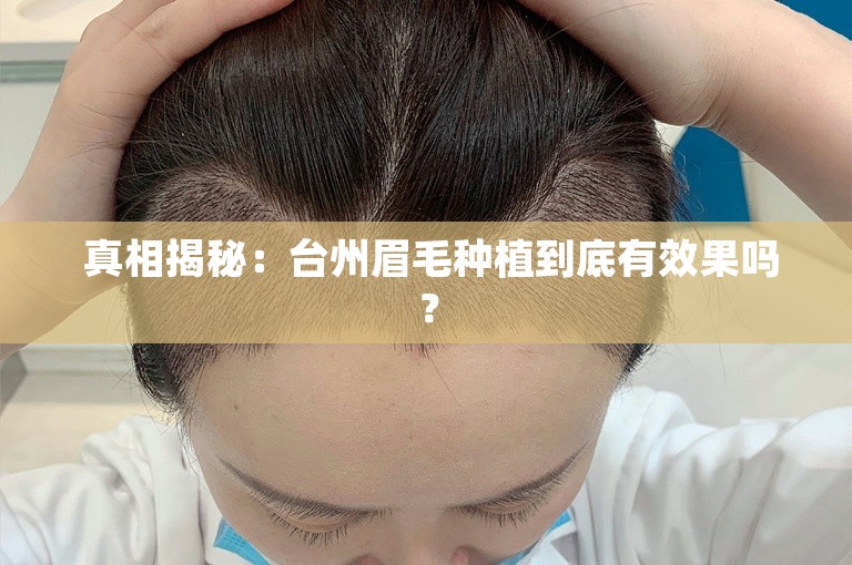  真相揭秘：台州眉毛种植到底有效果吗？
