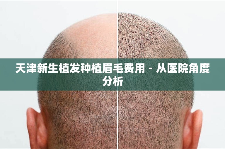 天津新生植发种植眉毛费用 - 从医院角度分析