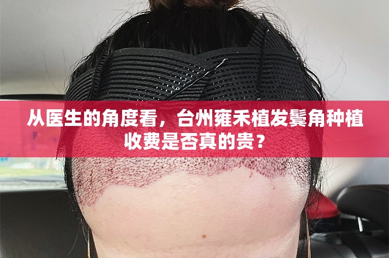 从医生的角度看，台州雍禾植发鬓角种植收费是否真的贵？