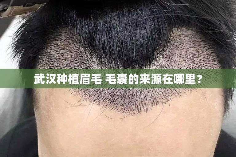 武汉种植眉毛 毛囊的来源在哪里？