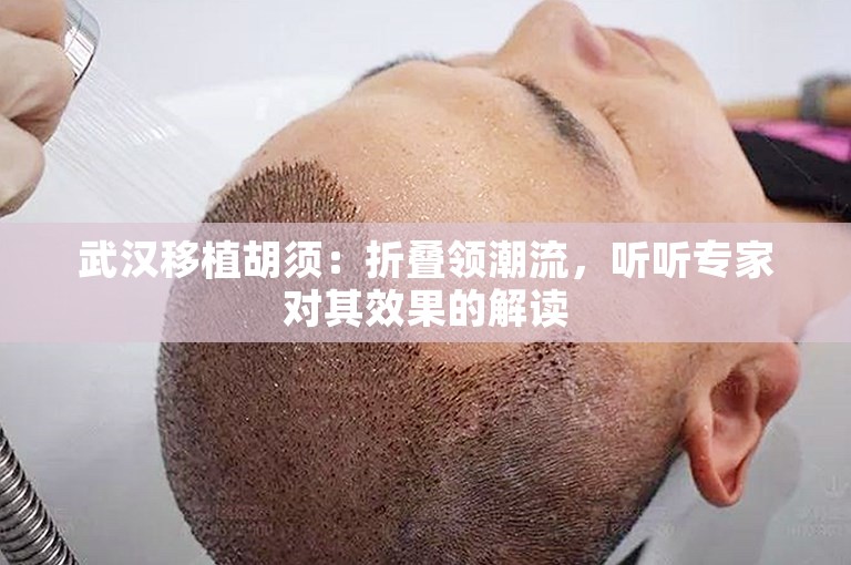 武汉移植胡须：折叠领潮流，听听专家对其效果的解读