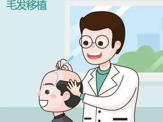 上海毛发移植手术效果好不好呢