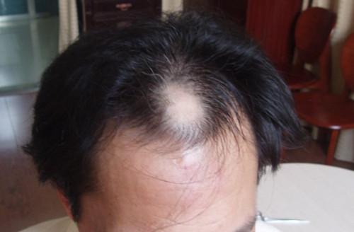 男性如何可以保养自己的头发