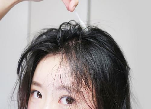 脱发小知识：导致脱发的情况有哪些呢？