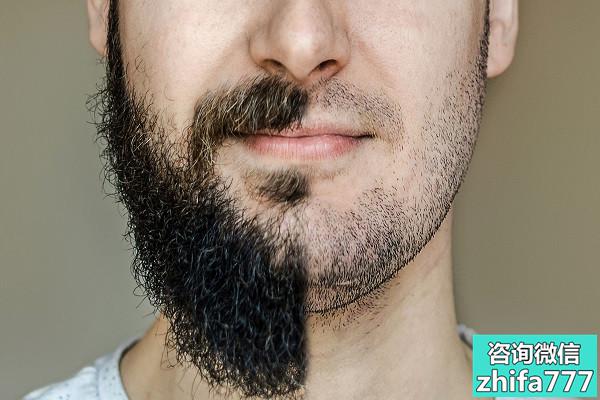 胡须种植后的脱毛期是怎么回事