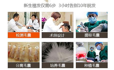 上海治疗男性脱发植发医院哪家靠谱