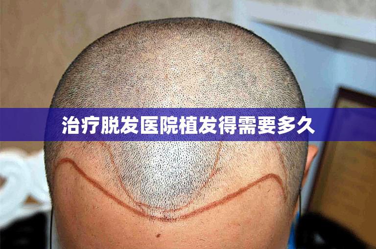 治疗脱发医院植发得需要多久