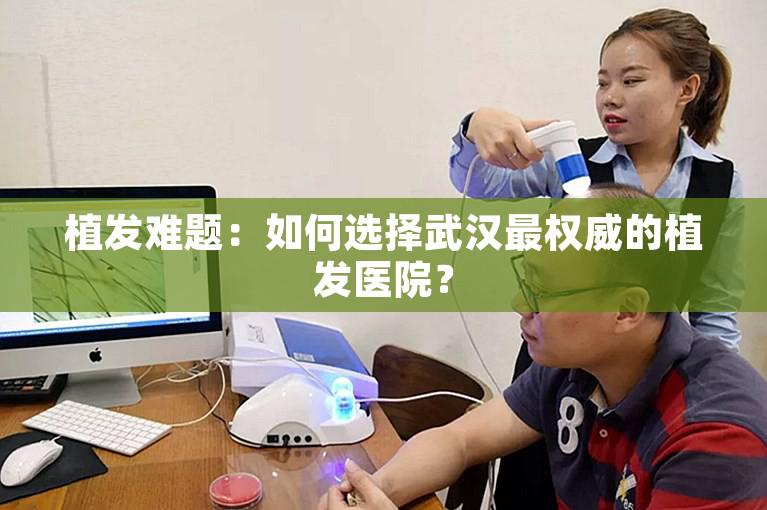 植发难题：如何选择武汉最权威的植发医院？