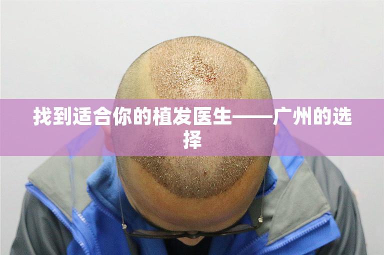 找到适合你的植发医生——广州的选择