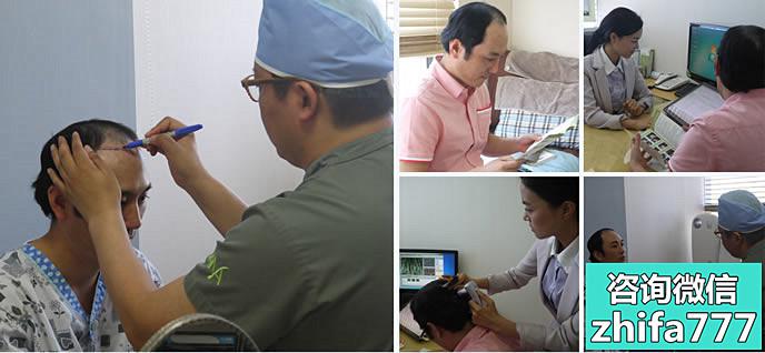 韩国多娜帮助患者解决遗传性脱发难题